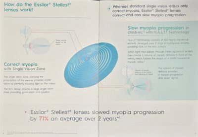 Diagram of Stellest lenses slowing myopia progression.